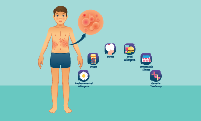 Allergen Awareness